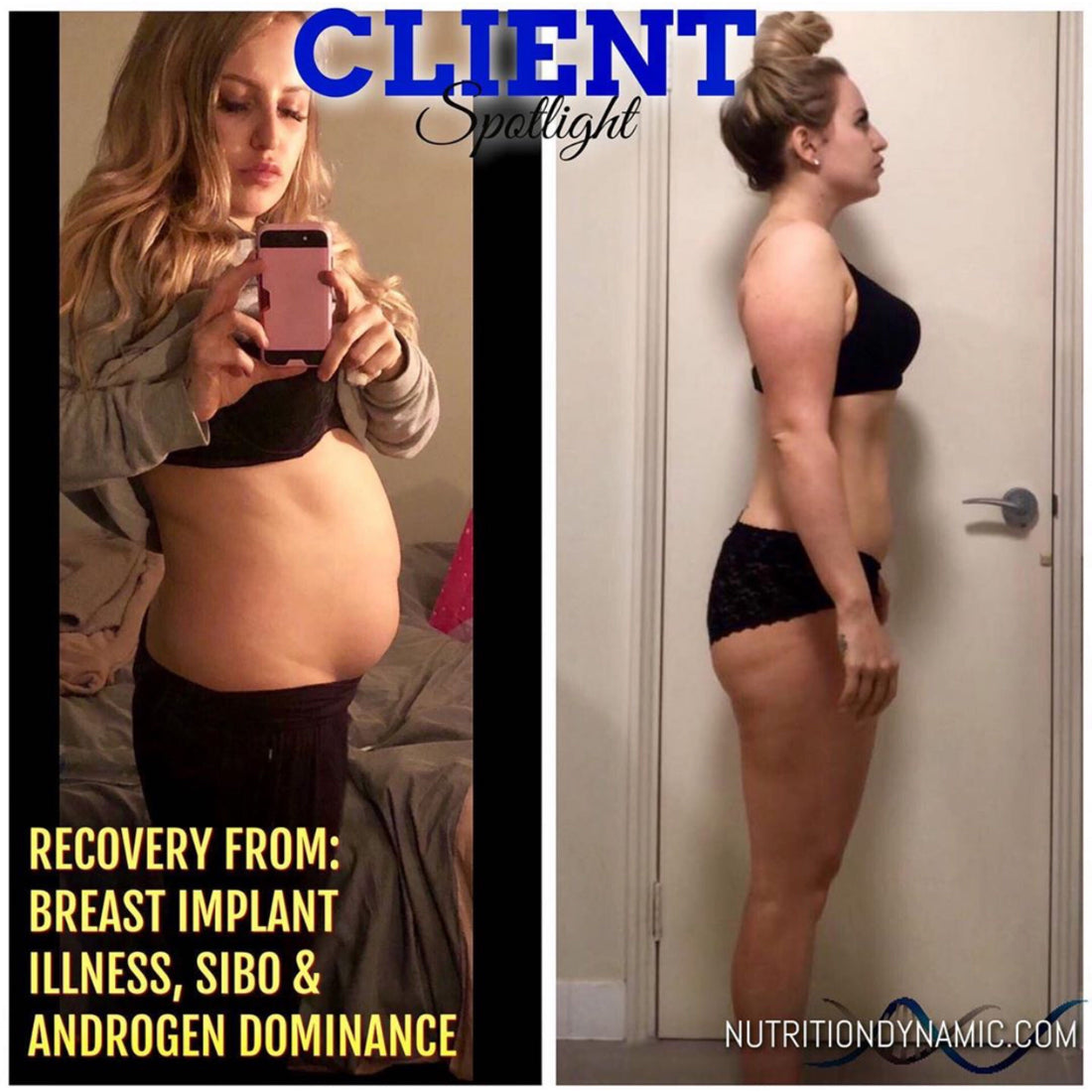 3 Phase System Healing Androgens Dominance, SIBO, & Metabolic Resistance